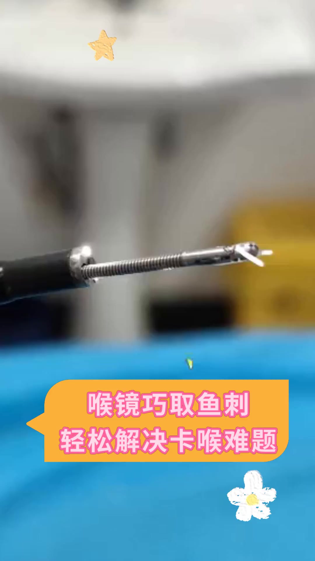 喉镜巧取鱼刺,轻松解决卡喉难题