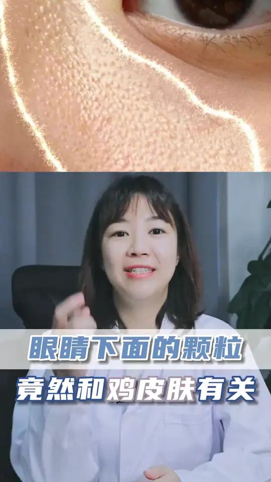 脸上也会长鸡皮肤?快看看你有没有长