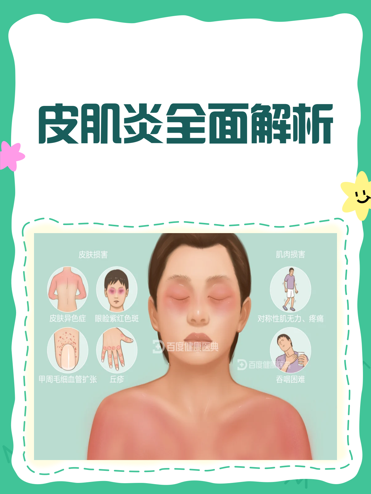 皮肌炎科普来啦!了解它,才能战胜它