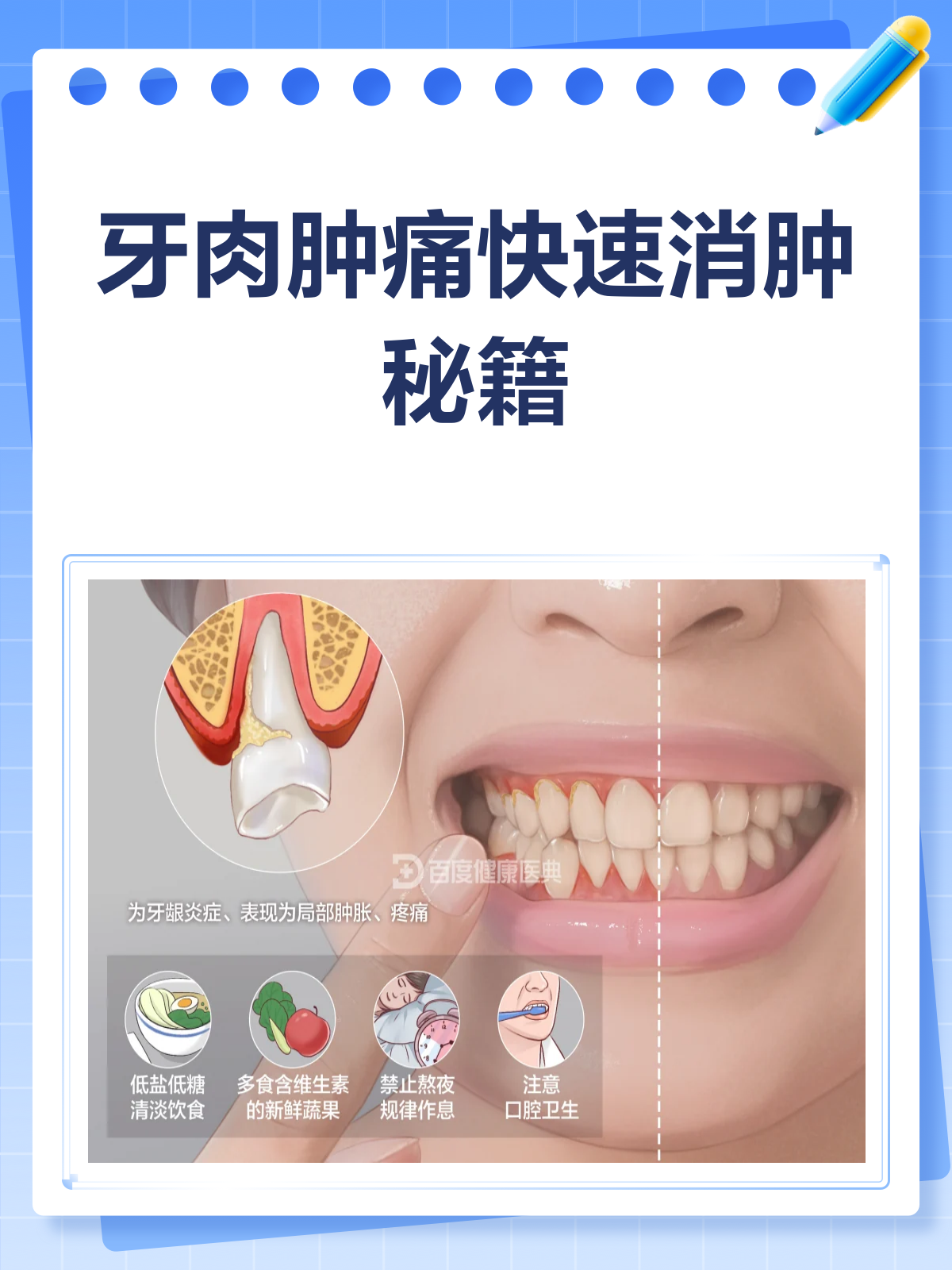 牙肉肿痛别硬扛!快速消肿全攻略来啦!