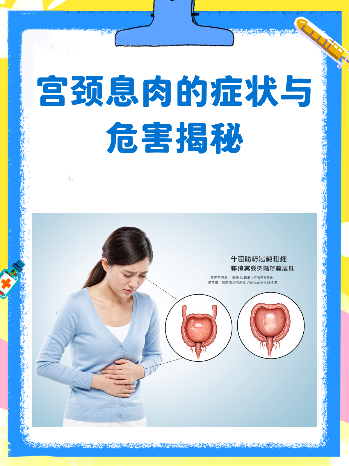 宫颈息肉,那些不可不知的症状与危害!