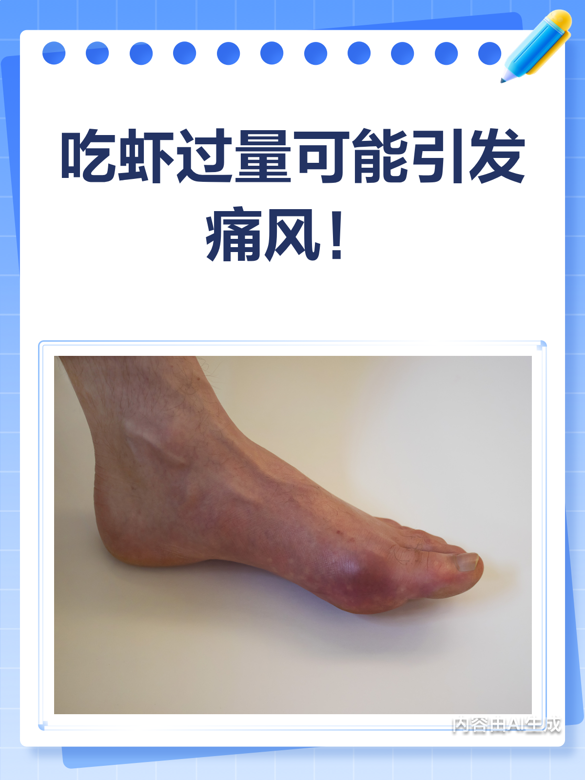 吃虾会导致痛风?真相原来是这样!