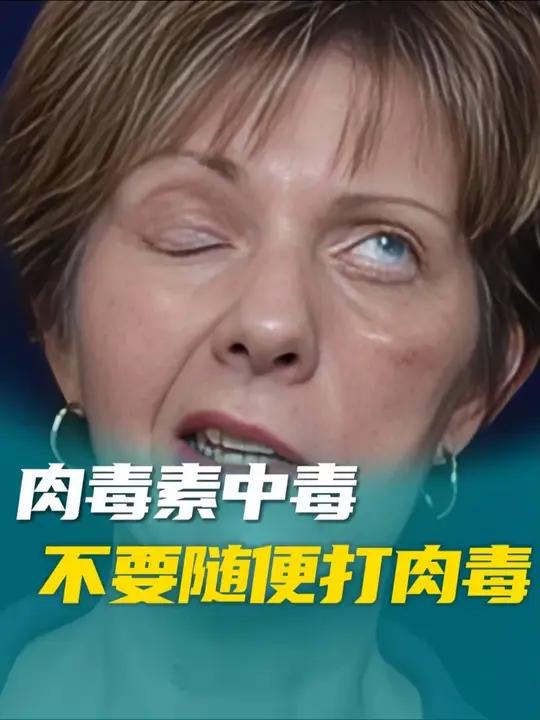 不要随便打肉毒素!后果比你想象的要严重!肉毒素中毒 肉毒素的危害和后遗症