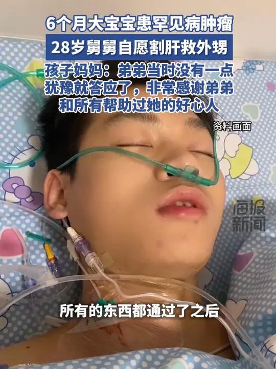 人间丨6个月宝宝患罕见病“横纹肌肉瘤”,28岁舅舅割肝救外甥