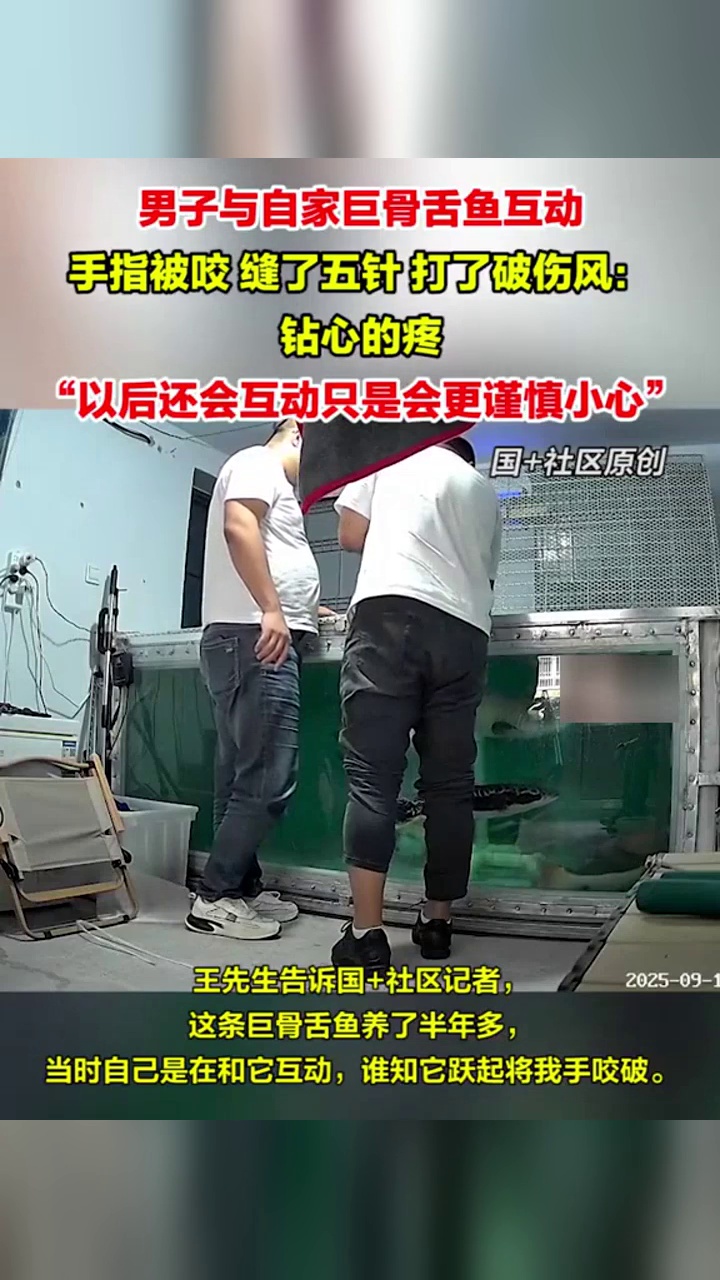 男子与自家巨骨舌鱼互动,下一秒手指被咬缝了五针:钻心的疼