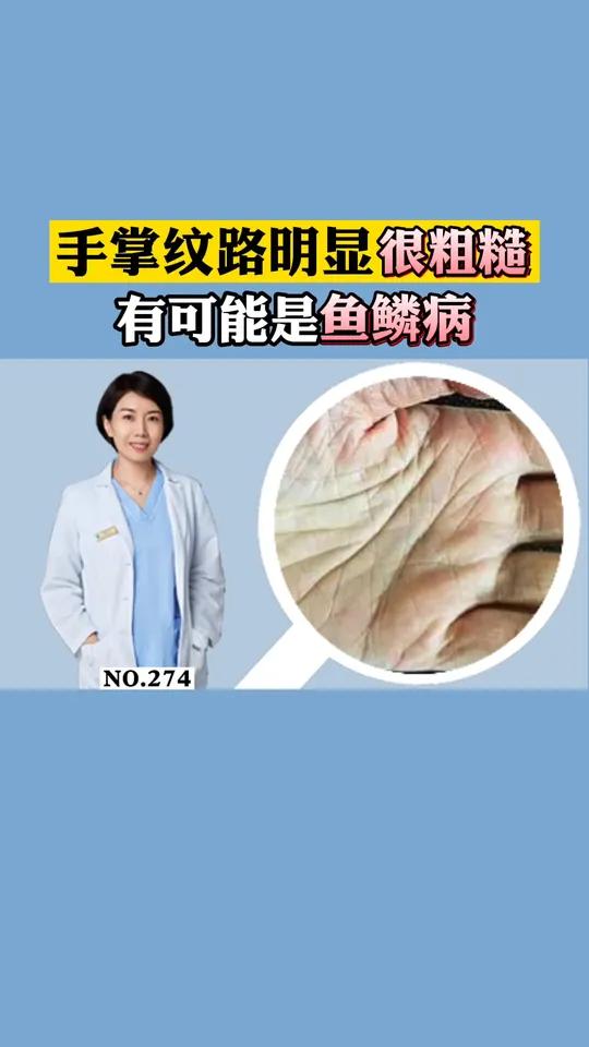 一干燥手脚就像“鱼鳞”一样还脱皮,难受又难看