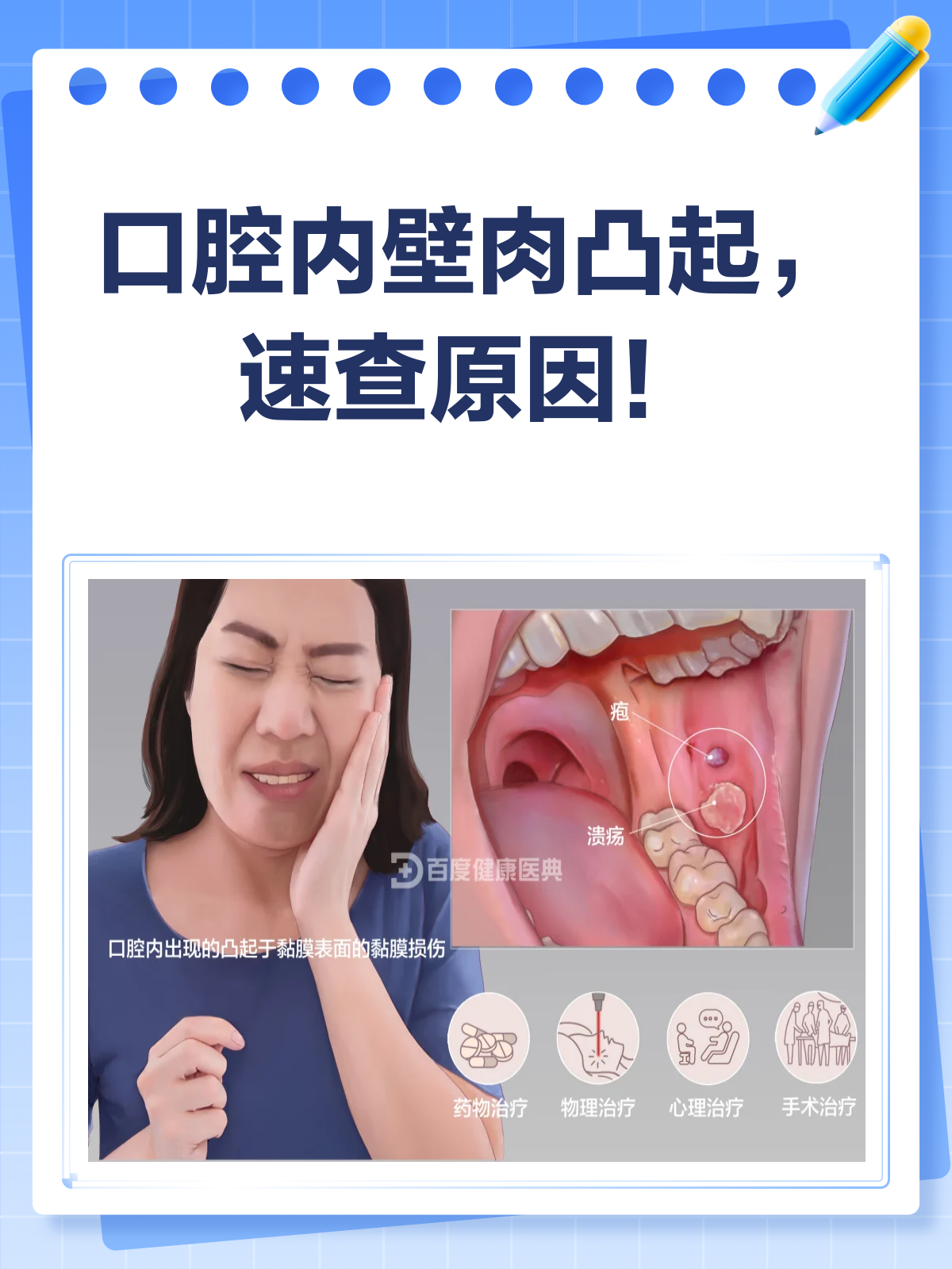 口腔内壁长肉凸起？别急，先看看这篇！