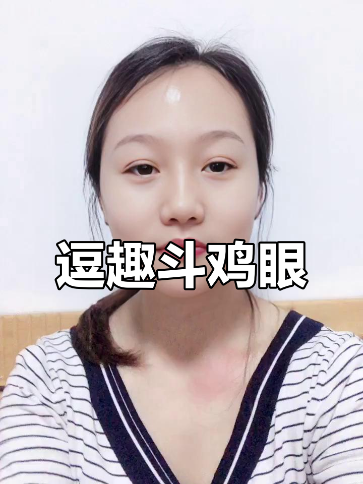 斗鸡眼大比拼,笑到不行!