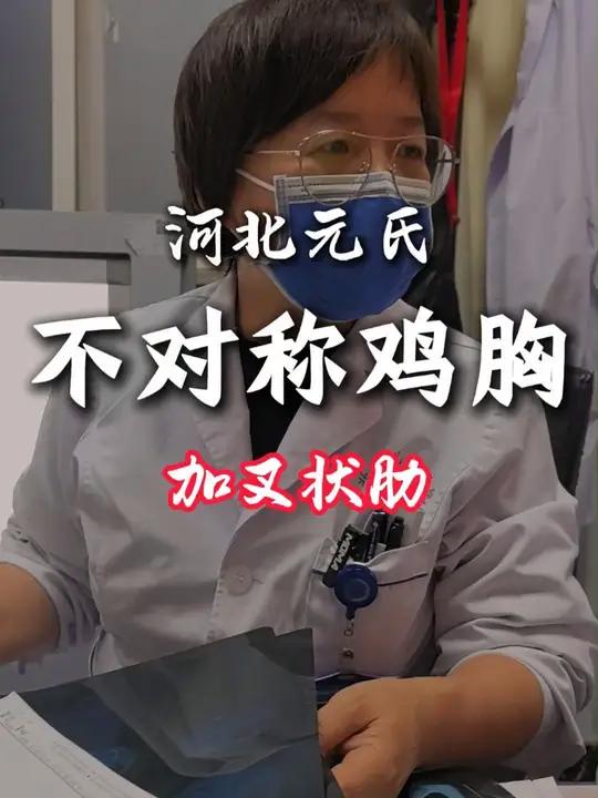 来自河北元氏的孩子不对称鸡胸,加叉状肋,但好在没有症状,暂时不影响心肺