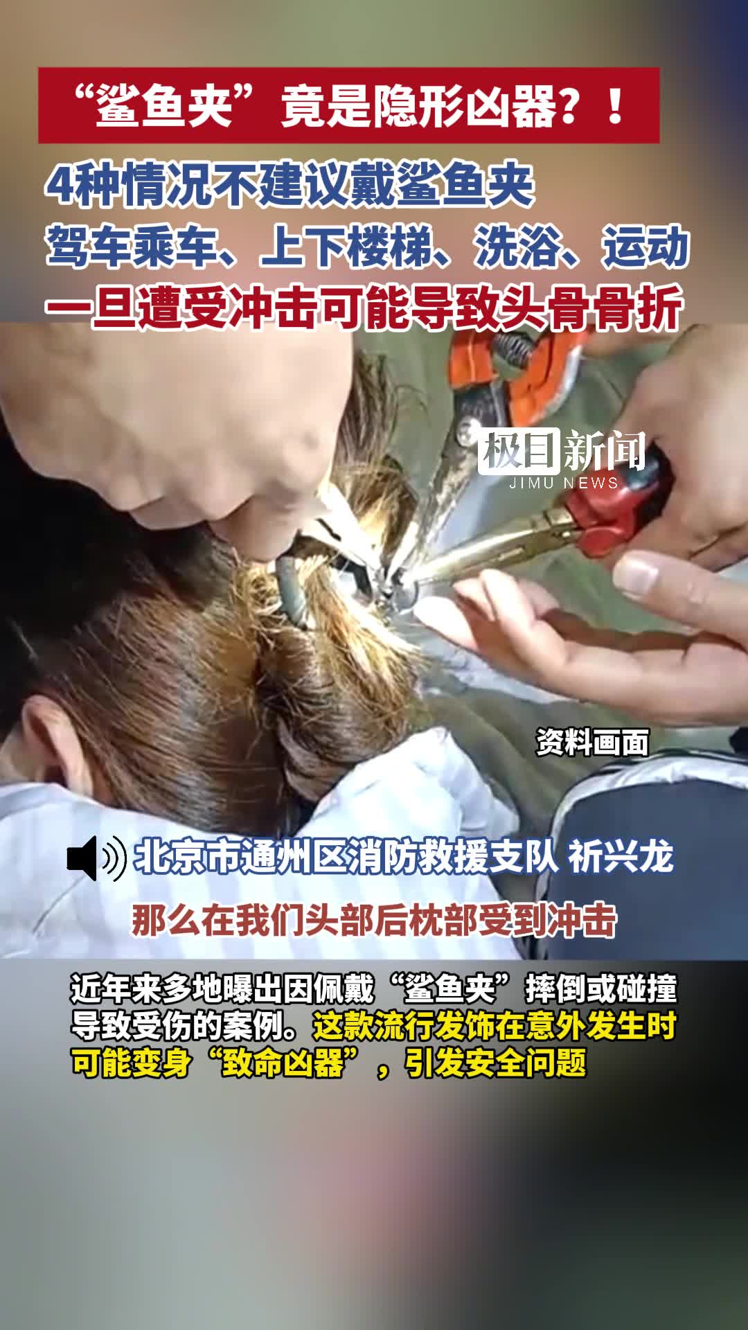 「视频」“鲨鱼夹”竟是隐形凶器?!4种情况不建议戴鲨鱼夹:驾车乘车、上下楼梯、洗浴、运动,