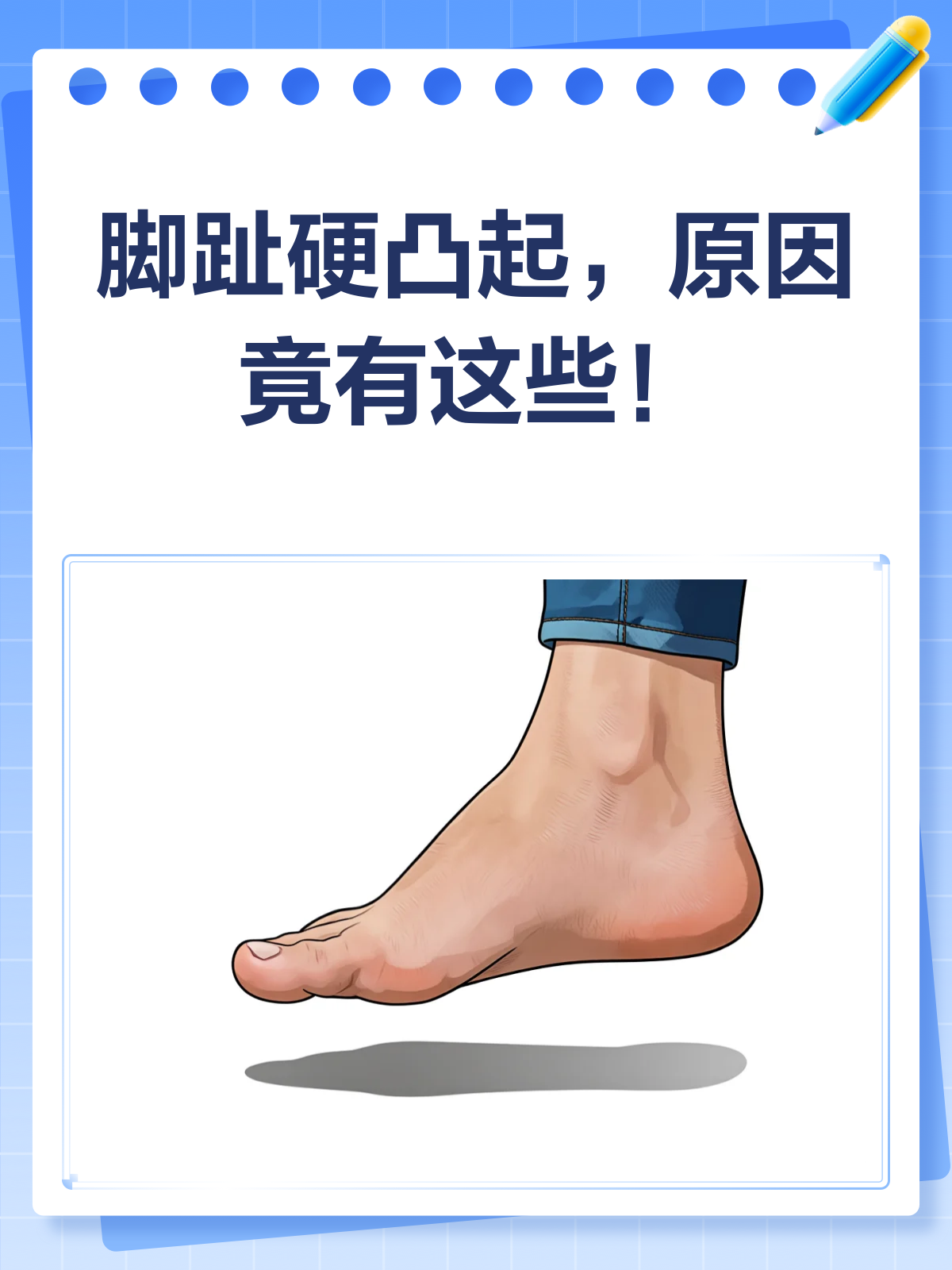 脚趾头硬凸起？揭秘跖疣、鸡眼还是啥？