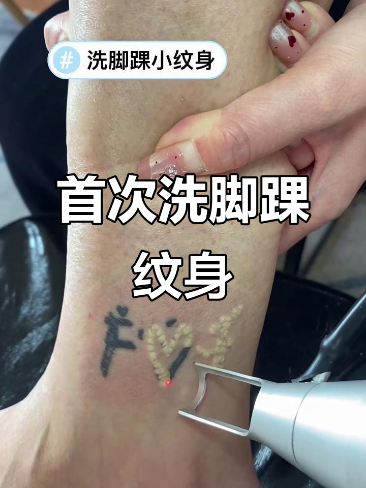 脚踝小纹身清洗,第一次洗纹身的体验