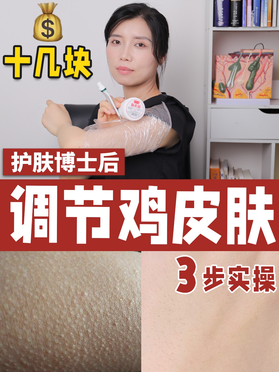 不到20!鸡皮肤用这2个东西搞定!
