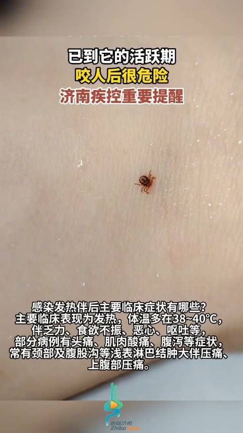 「「话筒」济南疾控重要提醒它咬人很危险」休假日,一顶帐篷、一片草坪、烧烤野餐加露营,好不惬