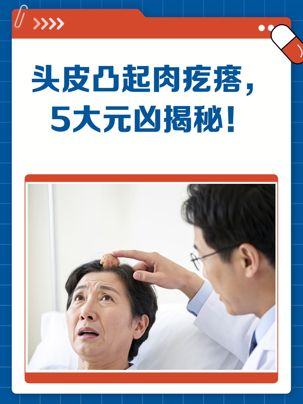 头皮上的肉疙瘩?揭秘背后的5大“元凶”!