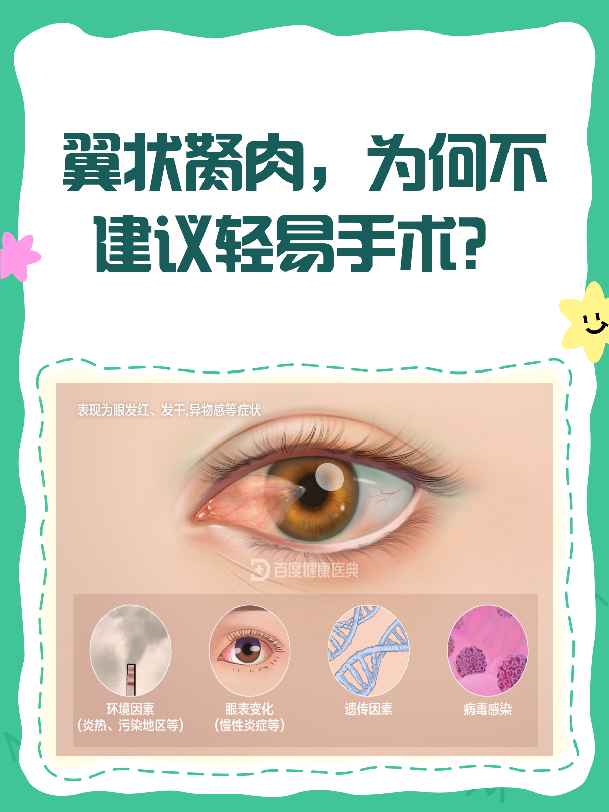 翼状胬肉何时该手术?一文给你讲明白!