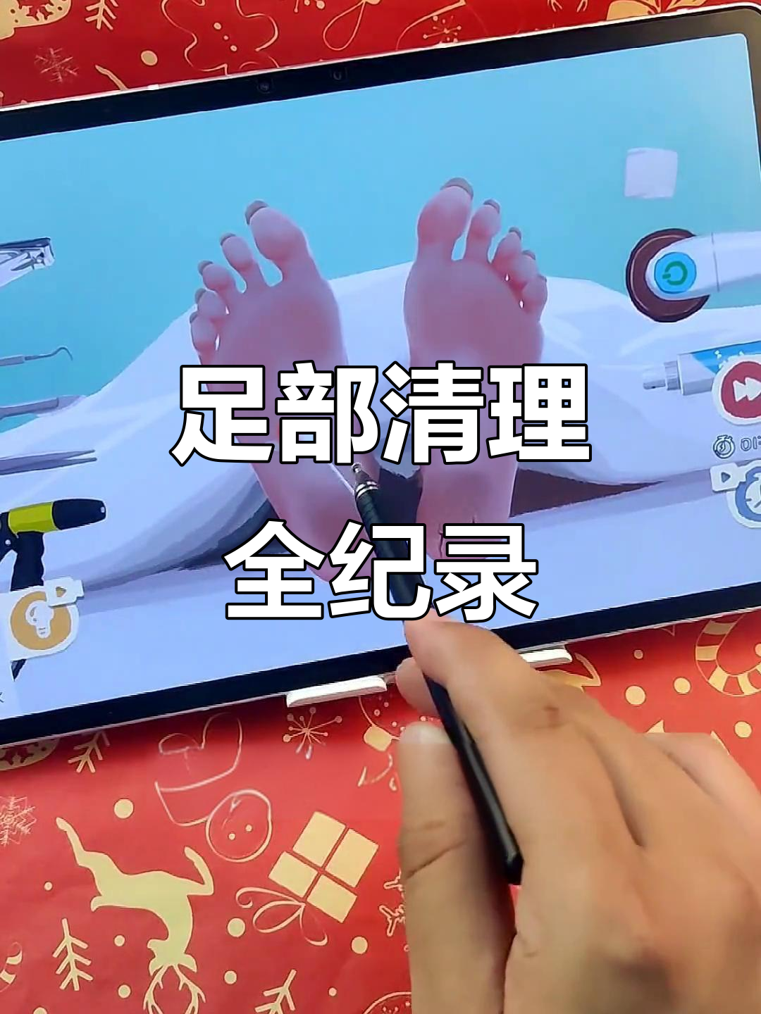 脚部清洁大作战,脓包、鸡眼一次搞定!