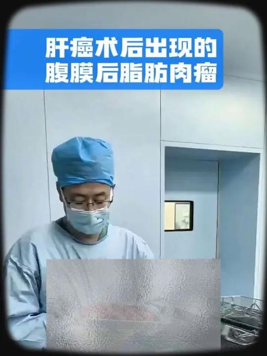 肝癌术后又来腹膜后肿瘤,手术很艰难,但是重点要保护的器官保住 #腹膜后肿瘤 #腹膜后脂肪肉