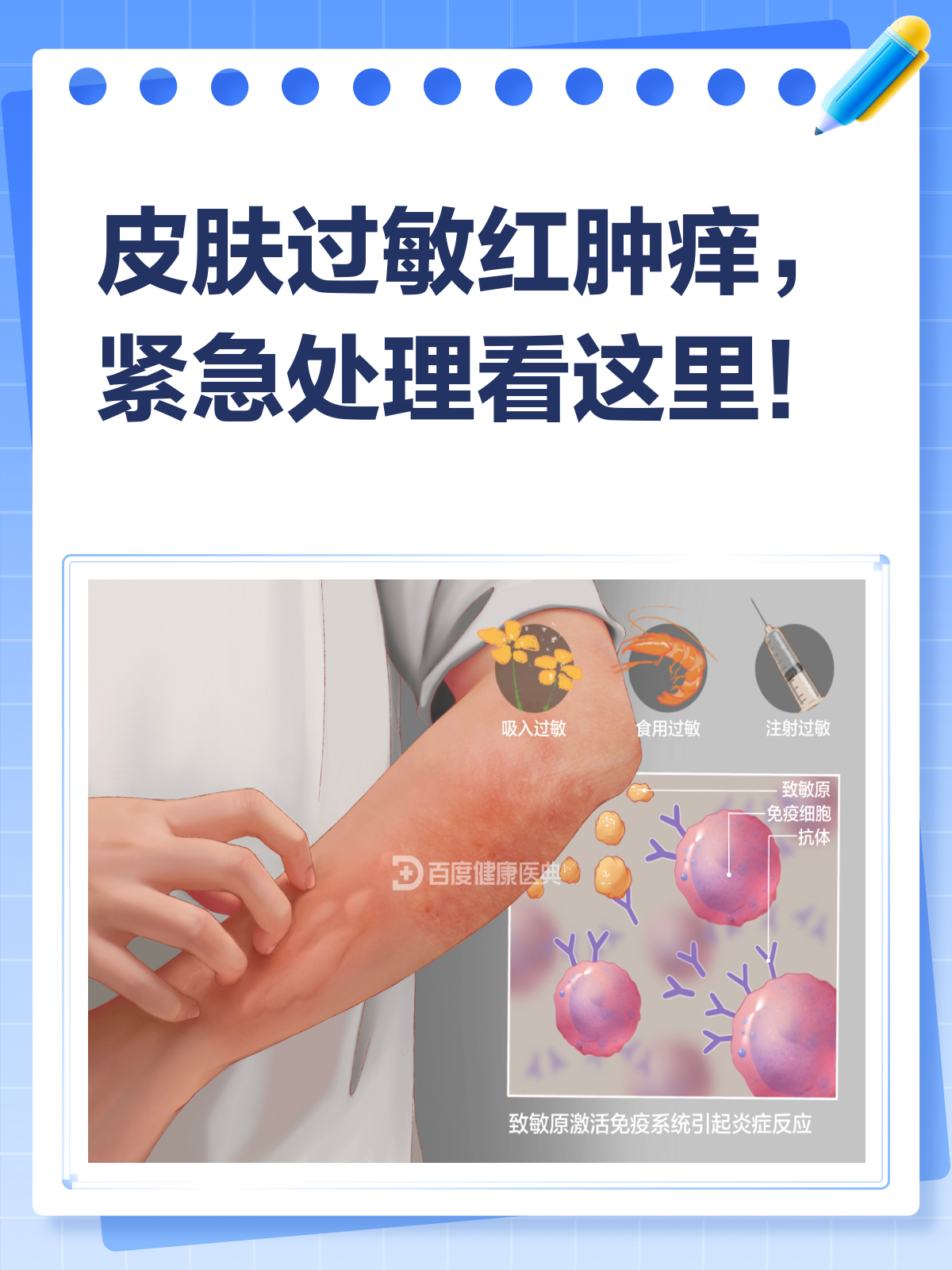 皮肤过敏大面积红肿痒？别急，专家教你紧急处理！