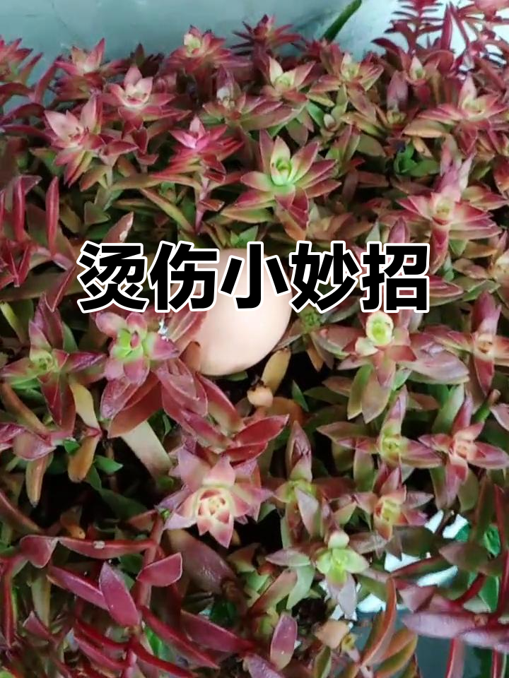 油水烫伤不用愁,白糖芝麻香油帮你搞定