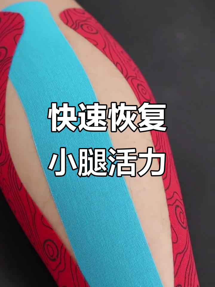 小腿肌肉酸痛?教你用鸡贴轻松缓解疲劳