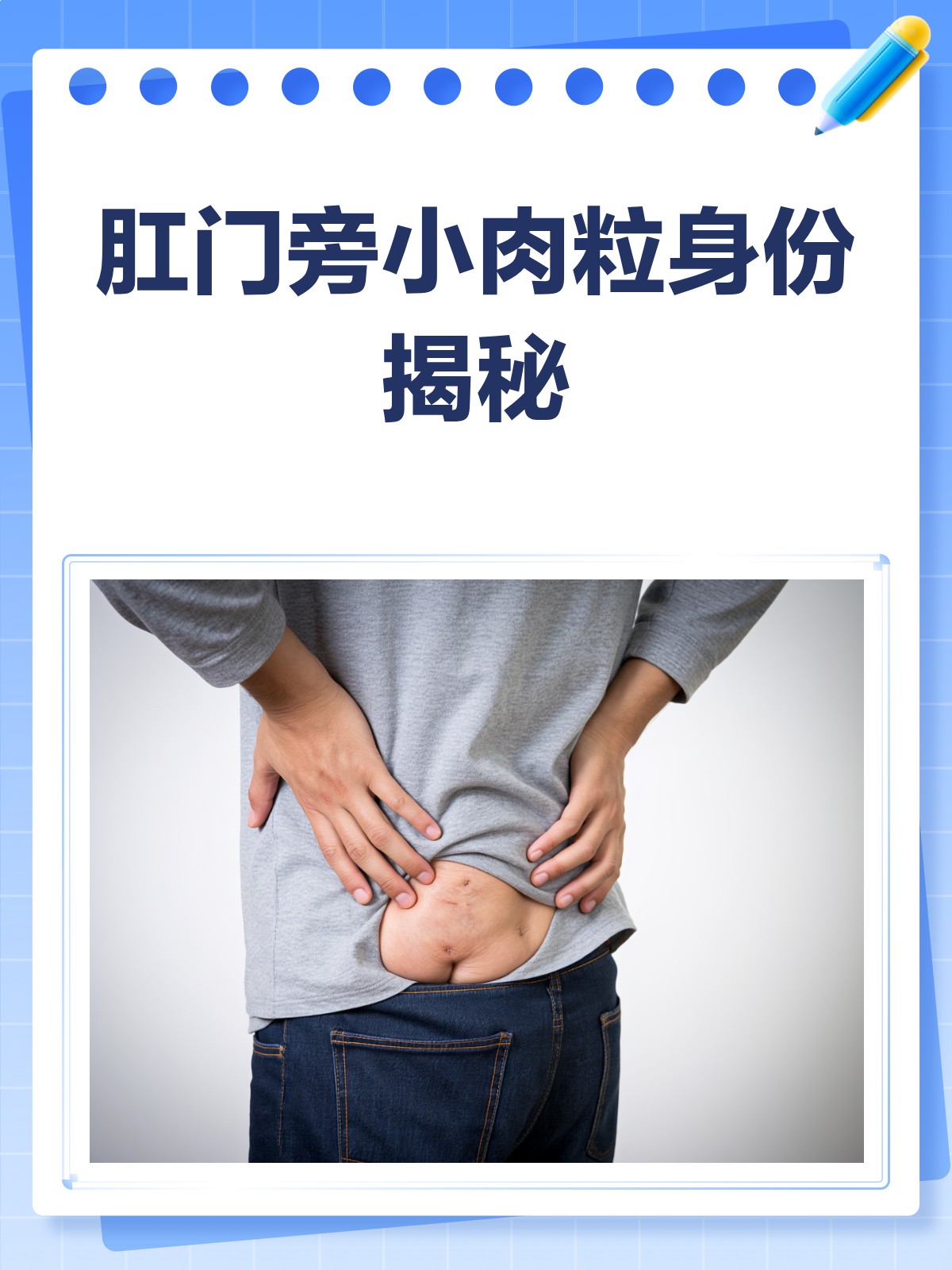 肛门旁小肉粒,是痔疮还是啥?