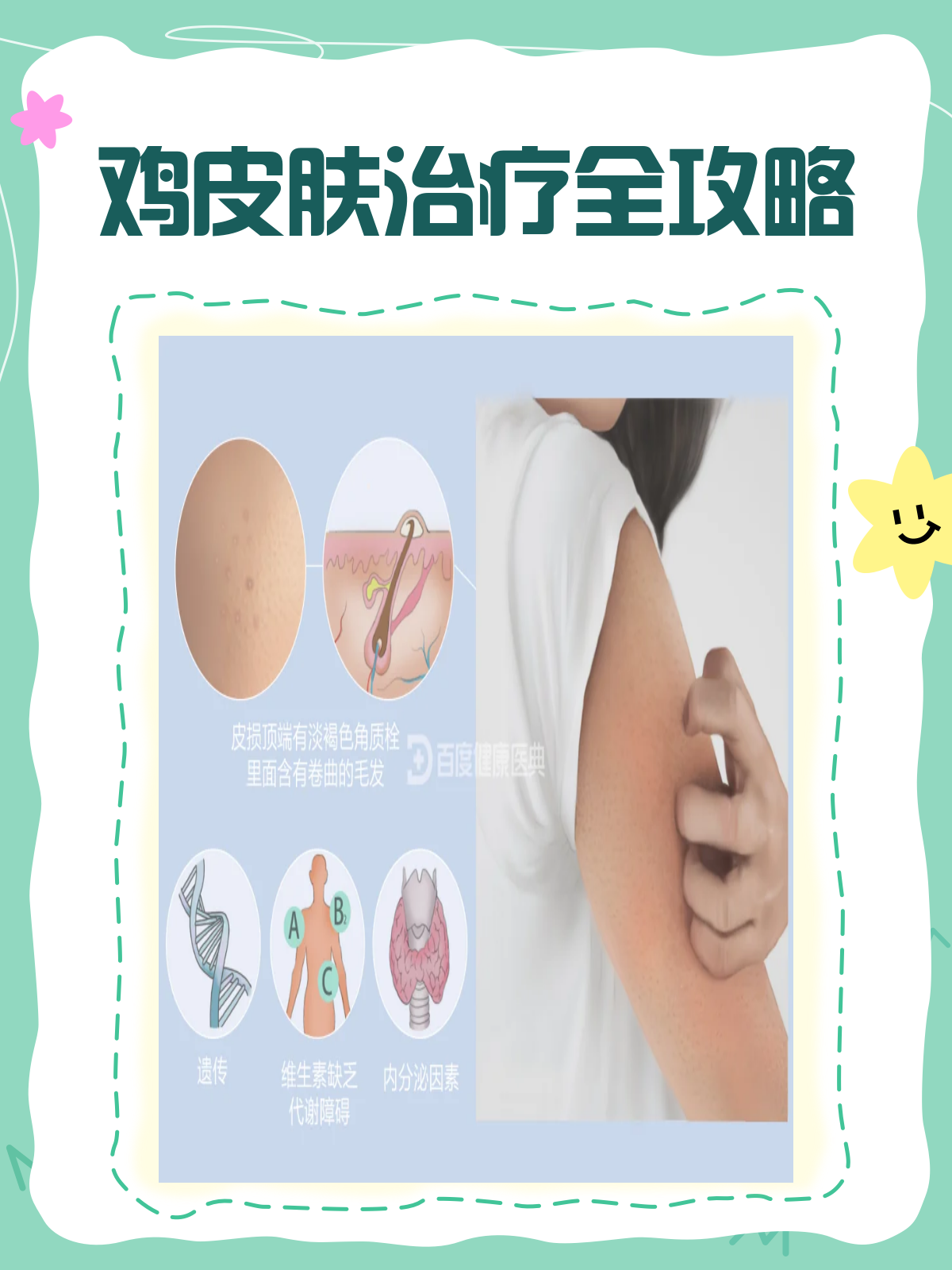 鸡皮肤能彻底根除吗?看完这篇就懂了!