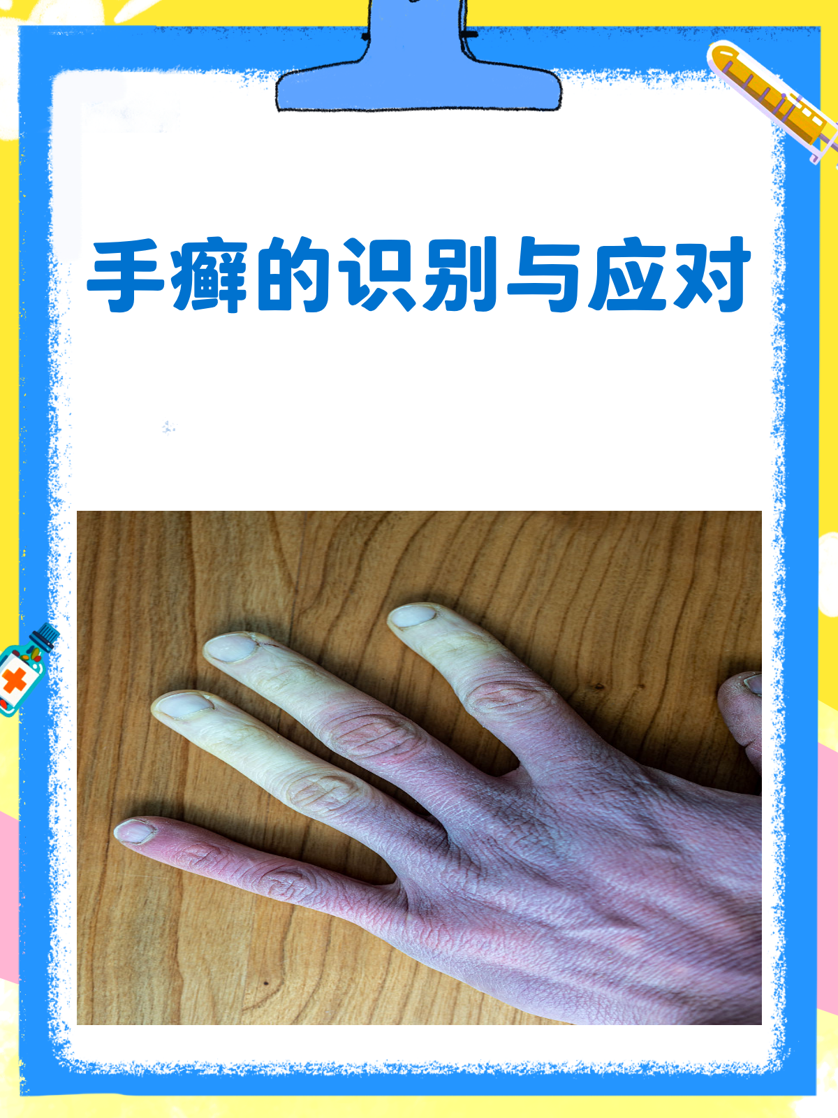 手癣来袭，你的“第二张脸”还好吗？