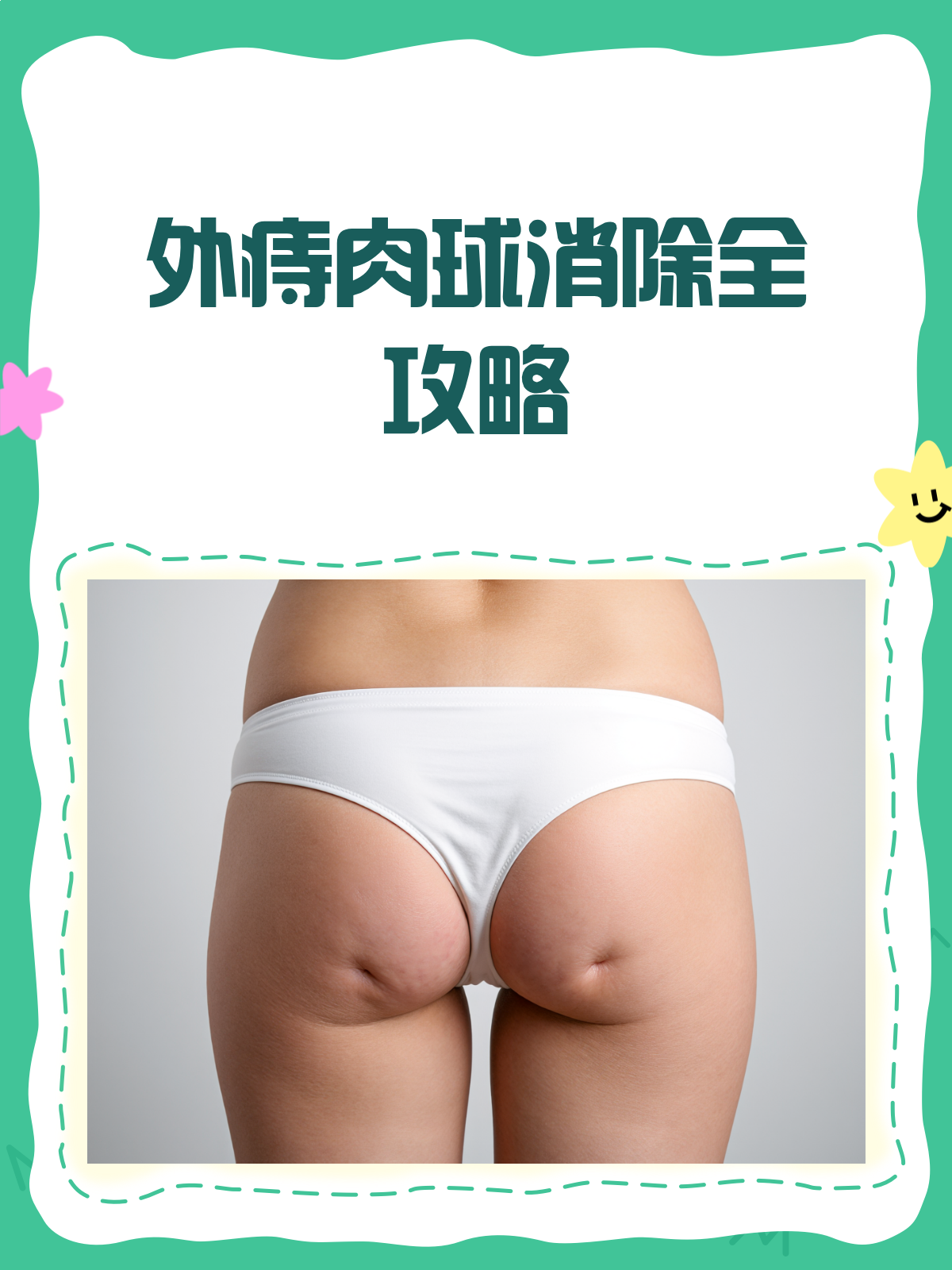 屁股痔疮外痔肉球?别急,消除攻略来啦!