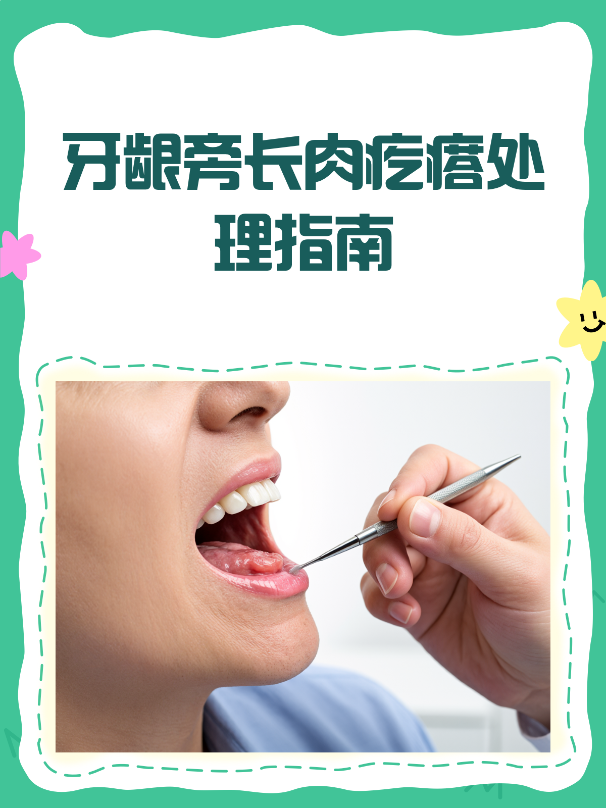 牙龈边长肉疙瘩？别急，这样处理就对了！