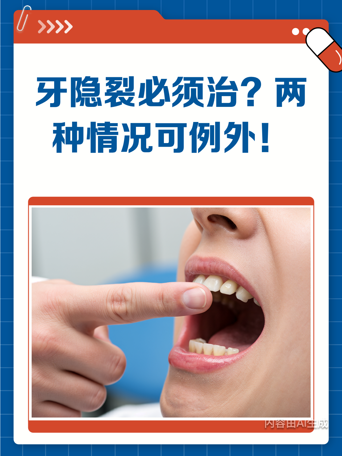 牙齿隐裂必须治?这些情况可能不用!