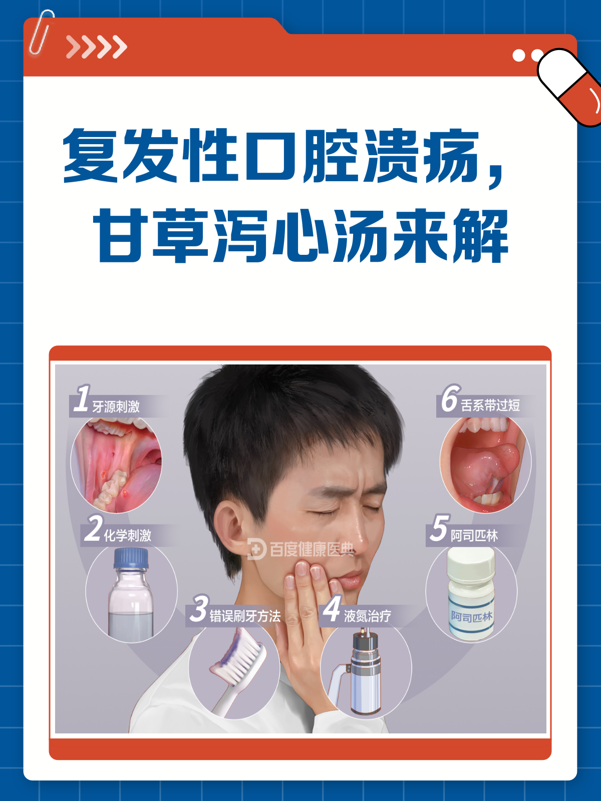 复发性口腔溃疡？试试甘草泻心汤！