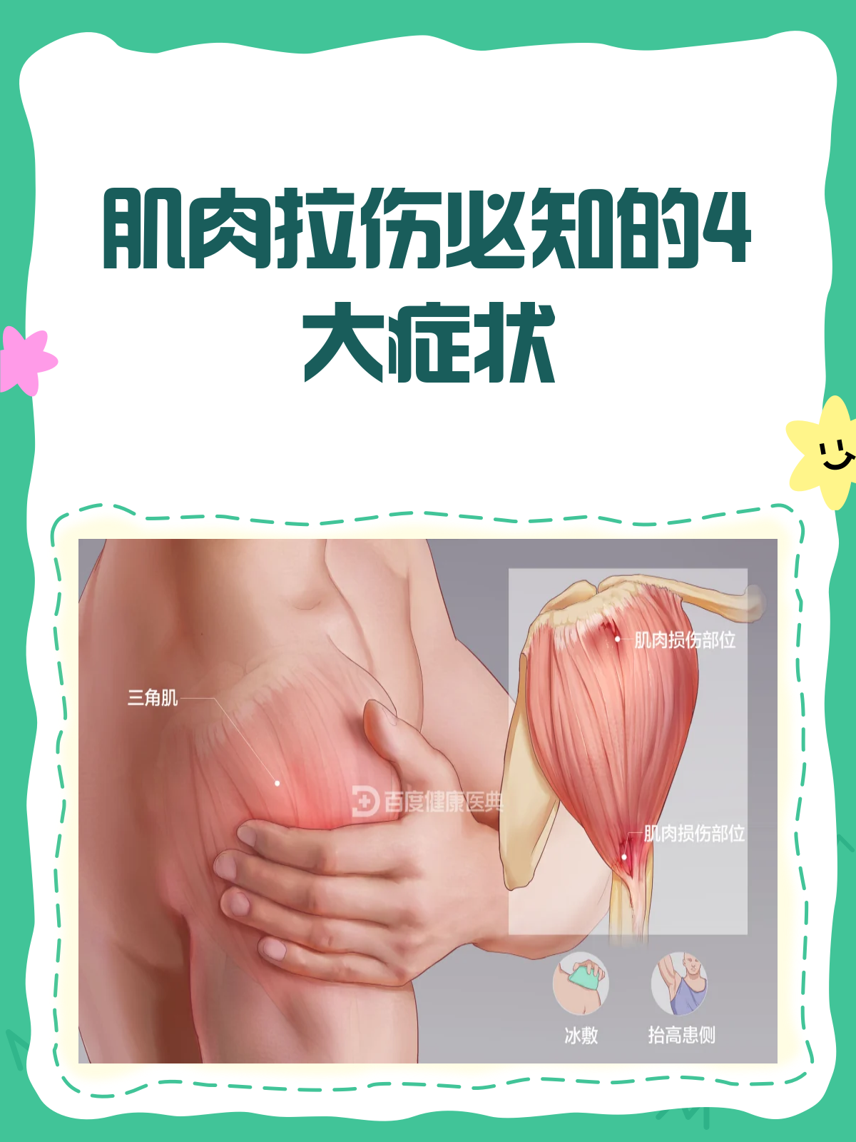 肌肉拉伤来袭?这些症状你得知道!