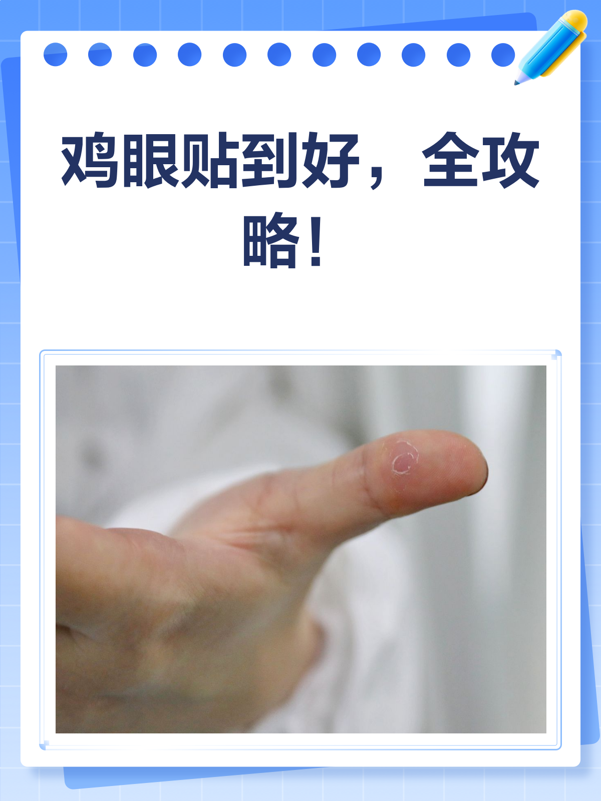 鸡眼贴全攻略!从贴到好,一步不落