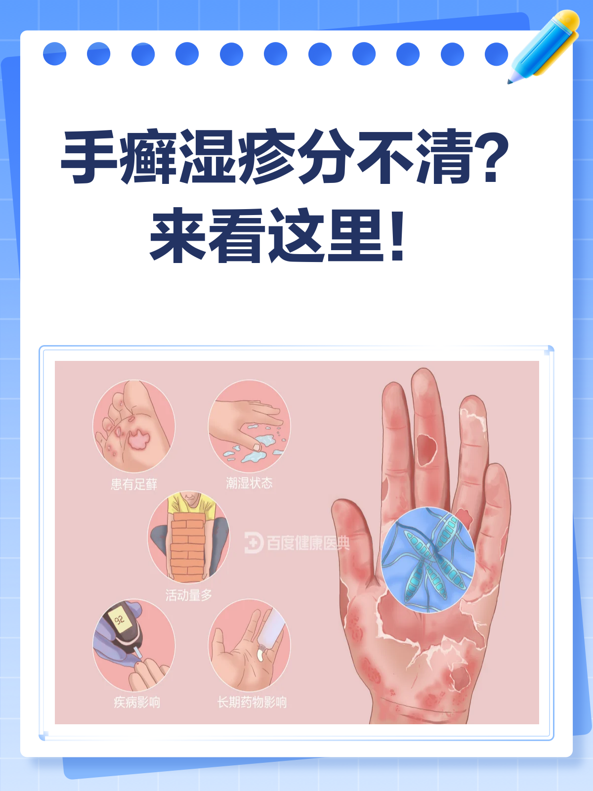 手痒脱皮分不清?手癣湿疹大不同!