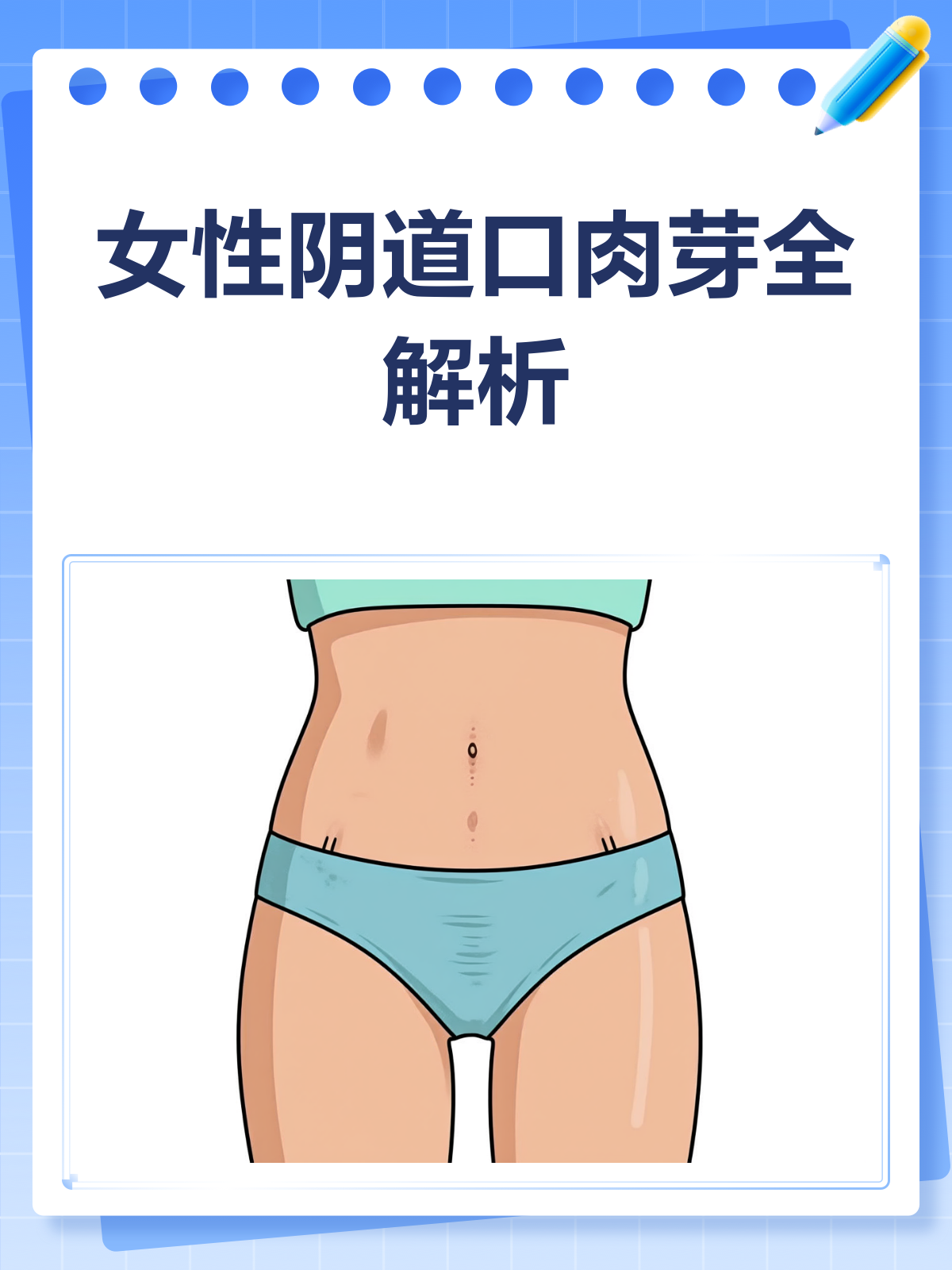 发现阴道口肉芽?别慌,先了解这些