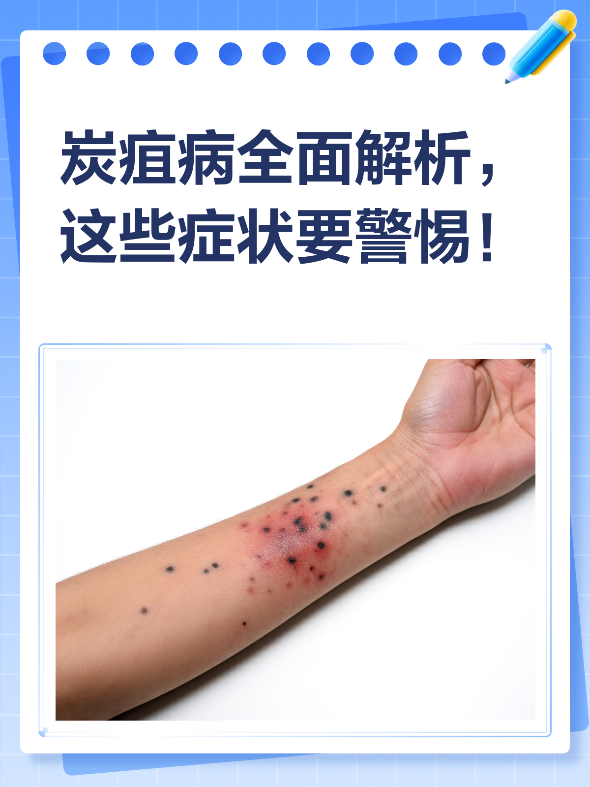 炭疽病来袭?了解症状,预防有招!