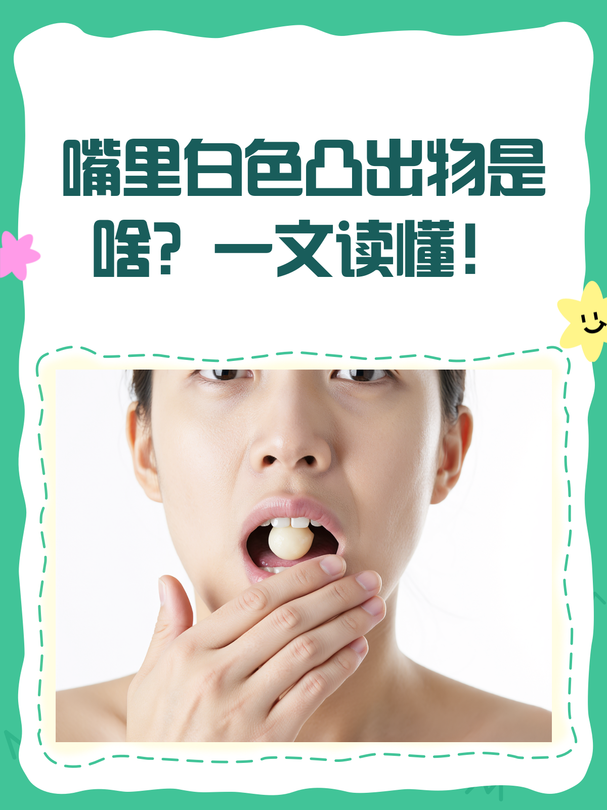 嘴里长了个白色凸出物是病吗？