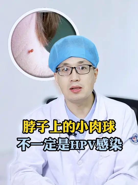 脸上、脖子上长了光滑的小肉球,可能是软纤维瘤,也叫皮赘。不是HPV感染