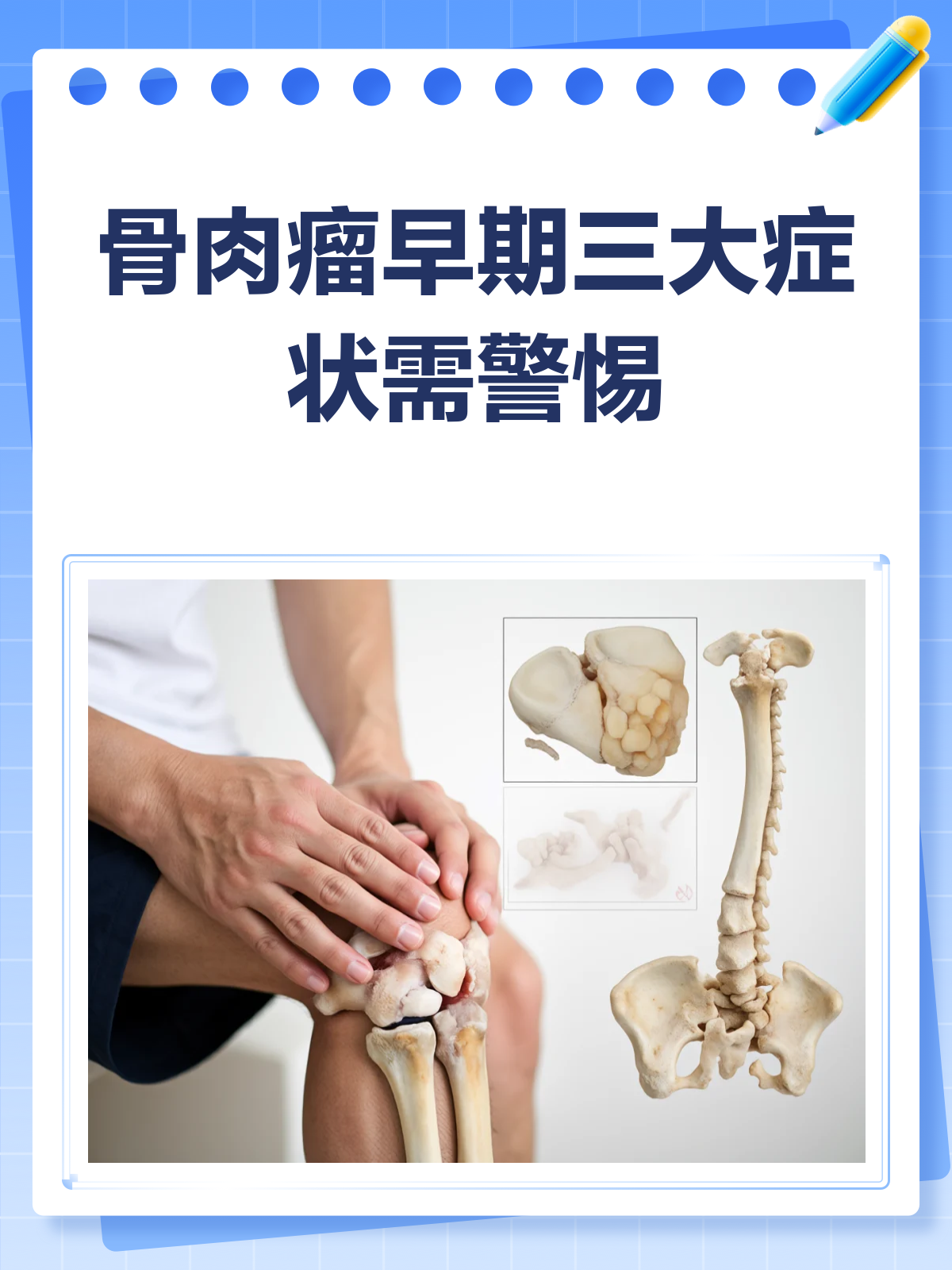 骨肉瘤早期，这些症状要警惕！