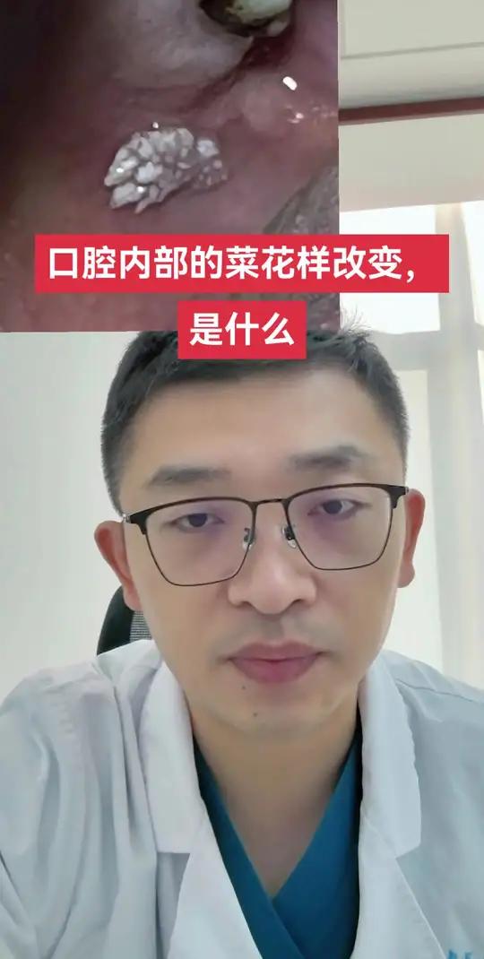 口腔内部的菜花样改变是什么