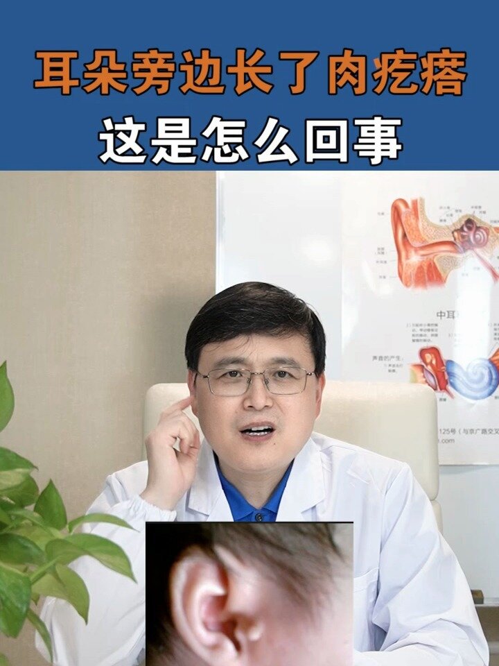 耳朵旁边长了肉疙瘩是怎么回事