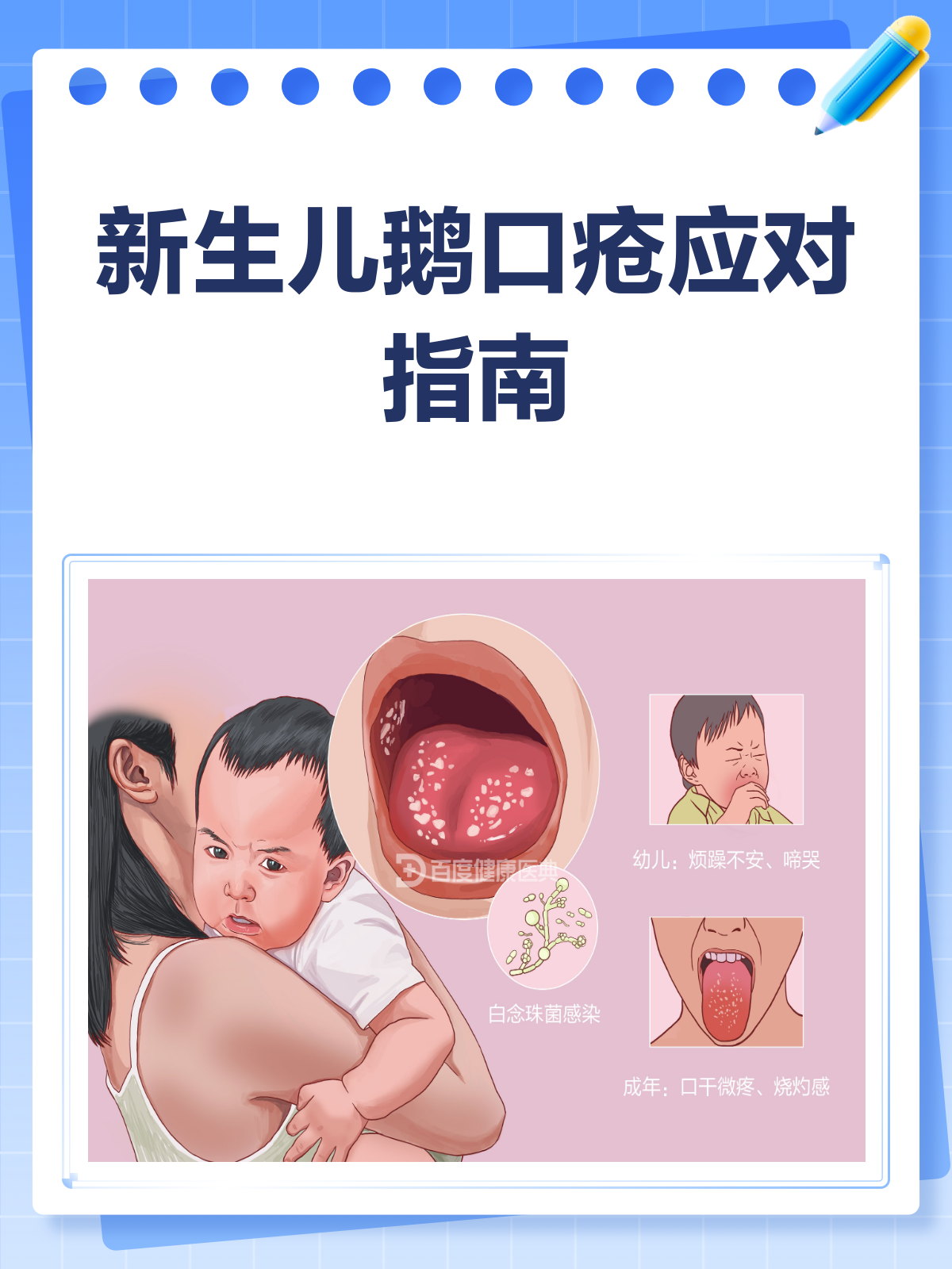 新生儿鹅口疮来袭?别急,应对攻略来啦!