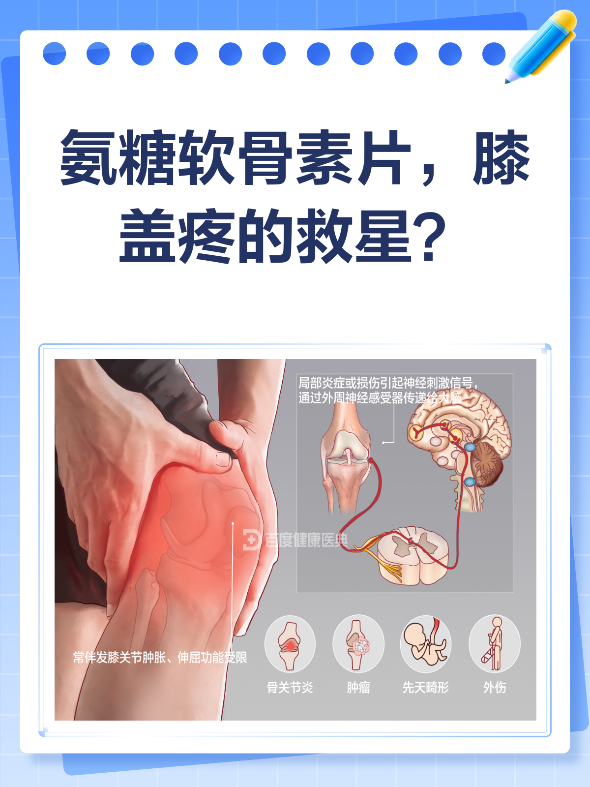 氨糖软骨素片,膝盖疼的救星还是安慰剂?