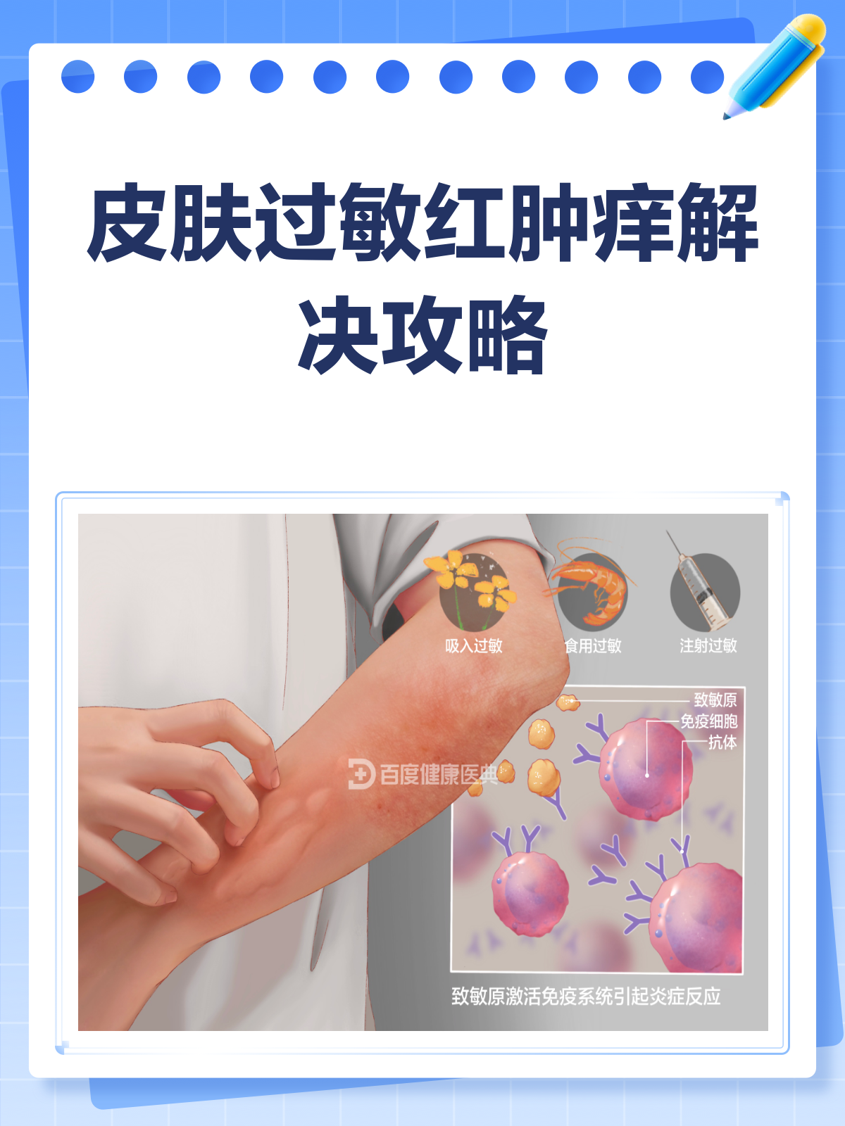 皮肤过敏大面积红肿痒?别急,这样解决!