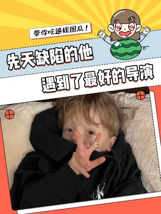 不完整的Mark有着天底下最好的妈妈 鲨鱼齿男孩 母爱 陪伴