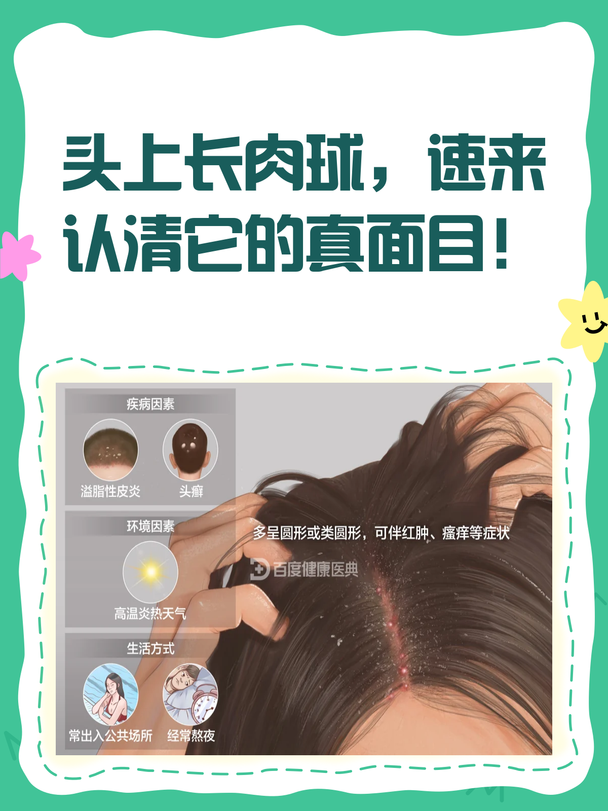 头上长肉球？别急，先搞清这几点！