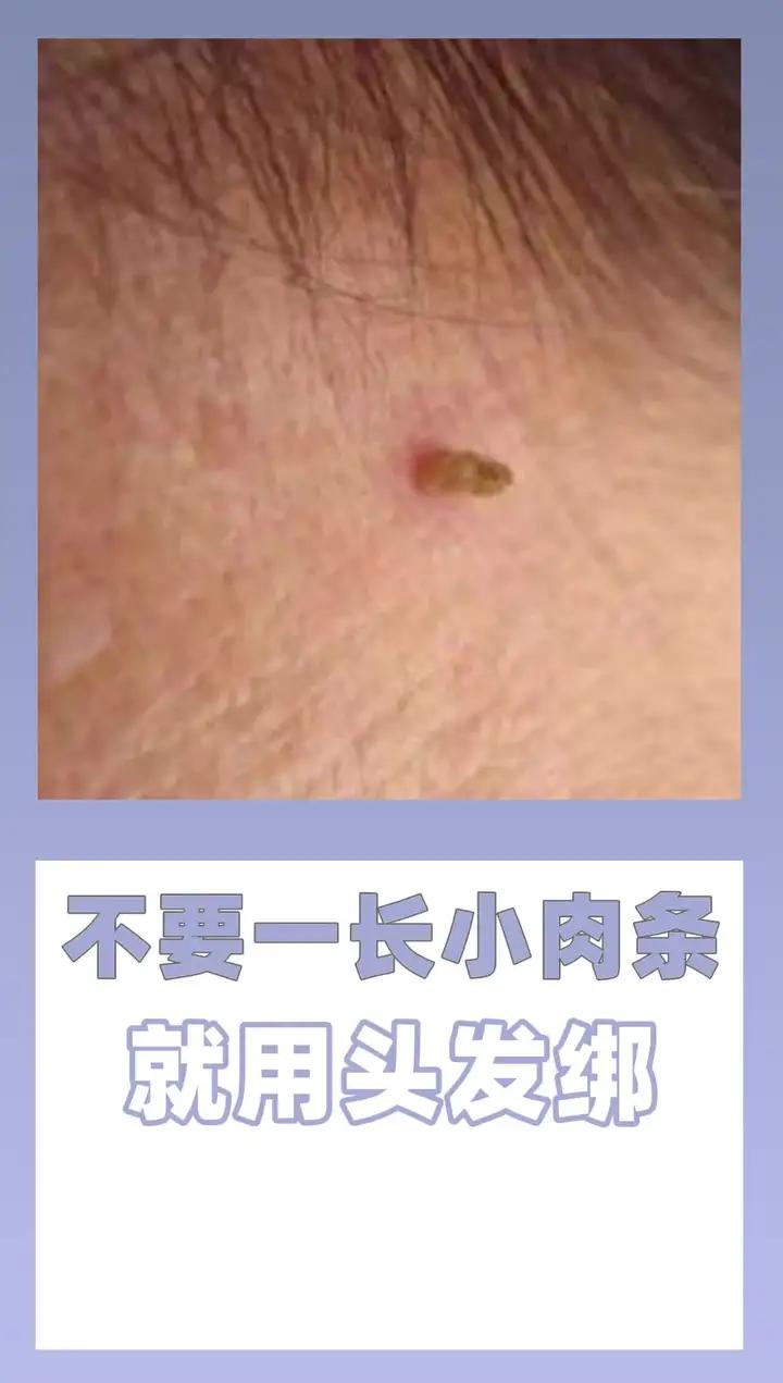 不要一长小肉条 就用头发绑