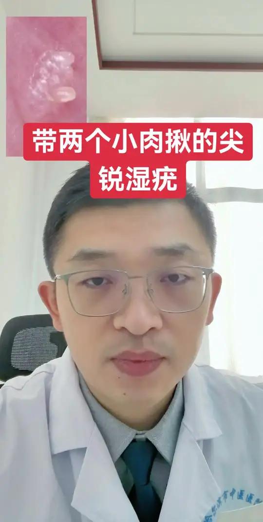 有小肉揪的尖锐湿疣