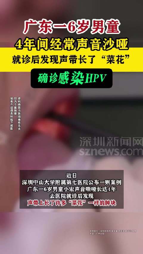 「广东一6岁男童经常声音沙哑查出HPV」近日,深圳中山大学附属第七医院公布一则案例,广东一